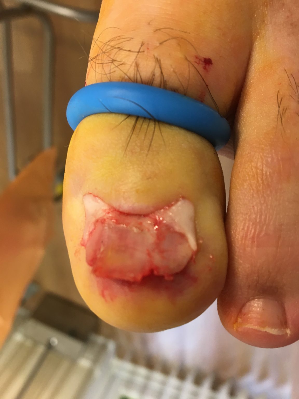 Does Publishing Graphic Podiatry Images Put Off Patients from Booking an Appointment?