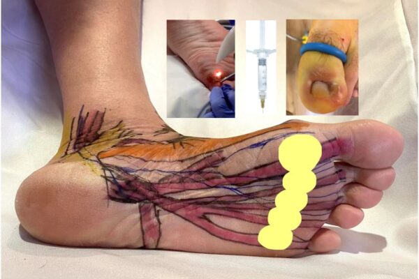 Compleet Feet Advanced Podiatry for Website