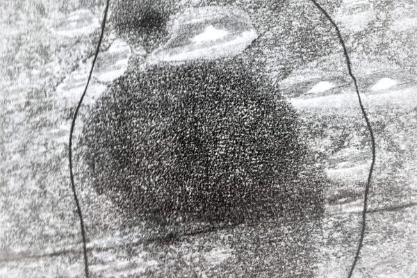 Identifying foot pain