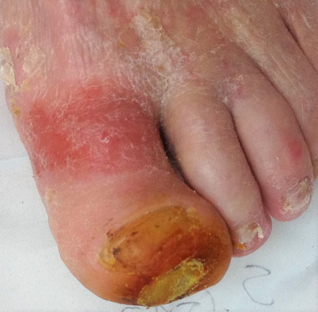 Struggling Podiatry Diabetic Footcare – K. Waller
