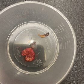 Large black head(comedone) and mole removal